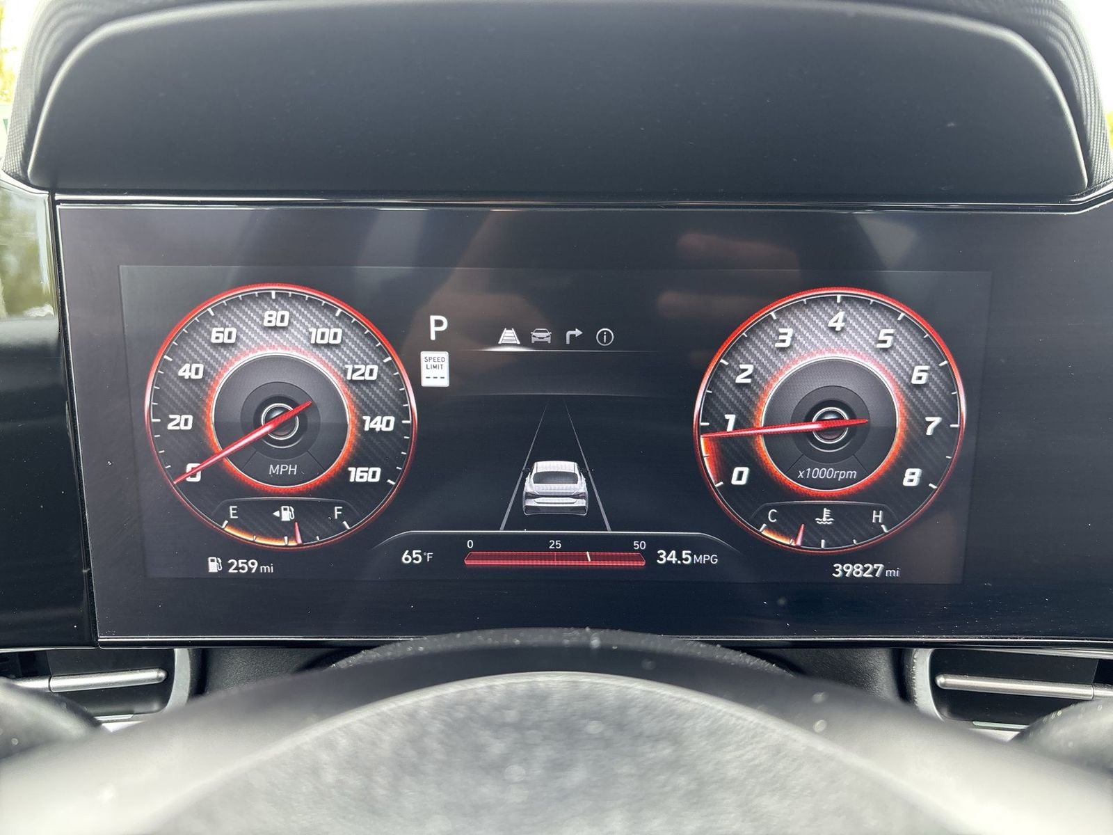 2024 Hyundai ELANTRA SEL Convenience